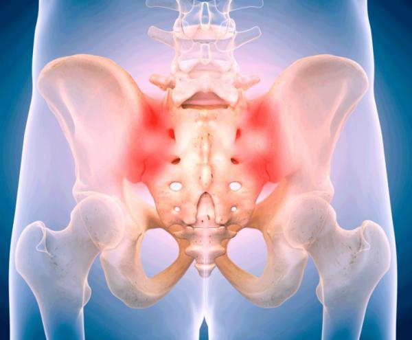 Ισχιαλγία : Πώς θα αντιμετωπίσετε τον πόνο