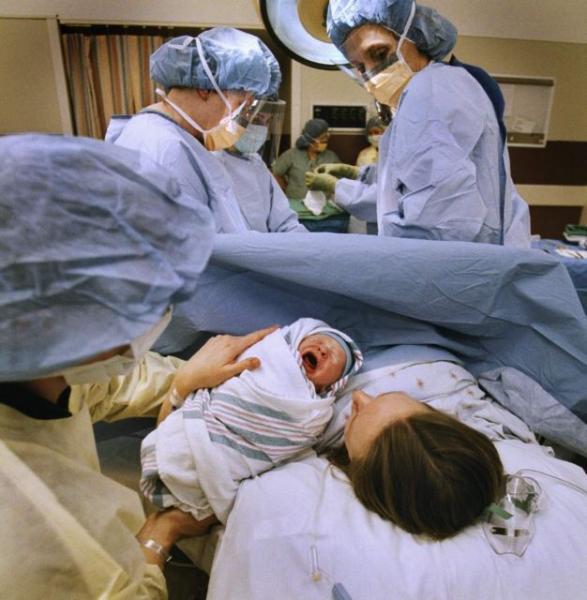 Επιτυχής εγκυµοσύνη παρένθετης µητέρας µετά από Προεµφυτευτικό Έλεγχο Συνδρόµου Alport