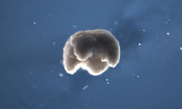 Δημιουργήθηκαν τα πρώτα ζωντανά ρομπότ