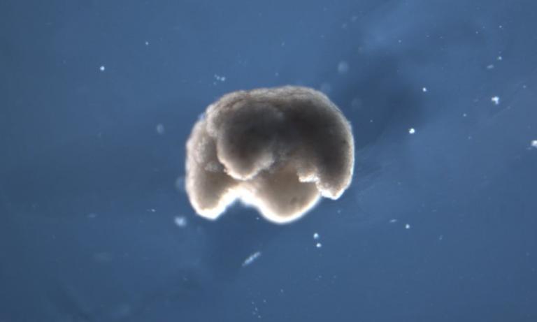 Δημιουργήθηκαν τα πρώτα ζωντανά ρομπότ