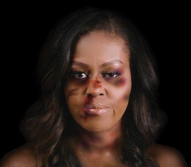 «Just because I am a Woman»: Μπριζίτ Μακρόν και Μισέλ Ομπάμα με… μώλωπες