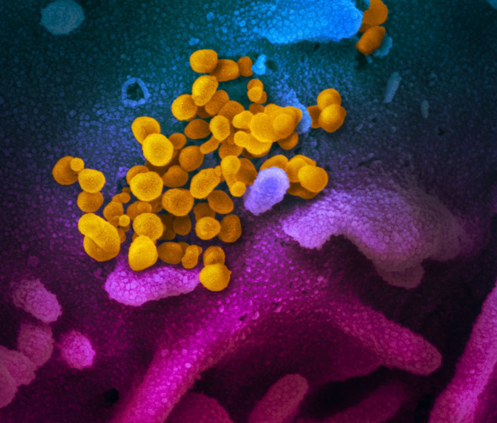 Κοροναϊός : Νέες εικόνες του θανατηφόρου ιού