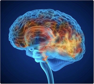 Ανεύρυσμα εγκεφάλου: Αυτά είναι τα πρώιμα συμπτώματα που δεν πρέπει να αγνοήσετε