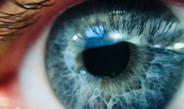 Αν μπήκε κάτι στο μάτι σας κάντε τα παρακάτω βήματα