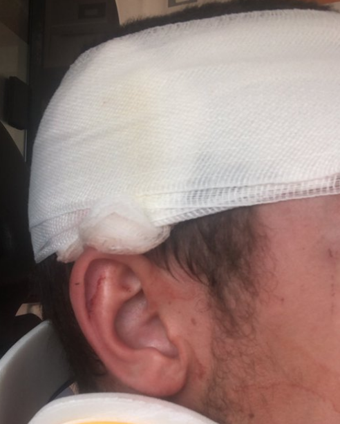 Λέσβος: Βίντεο – ντοκουμέντο από τον ξυλοδαρμό ρεπόρτερ από ακροδεξιούς