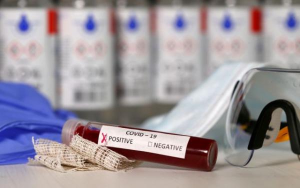 Ποιοι πρέπει να κάνουν το τεστ για τον κοροναϊό