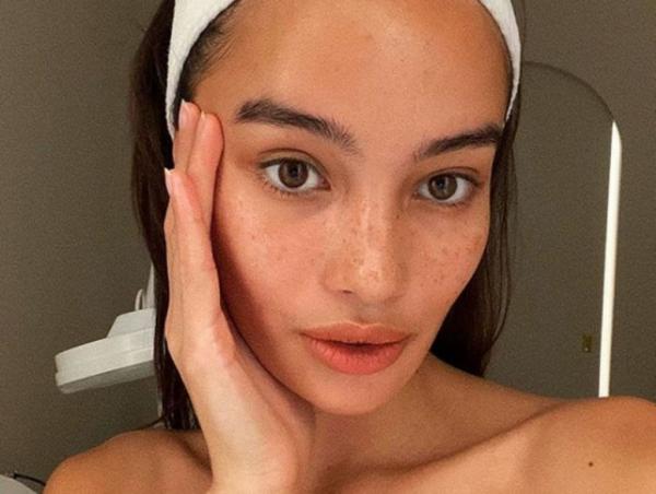 Οι τροφικές δυσαναξίες μπορούν να εμφανιστούν ακόμα και στο πρόσωπο