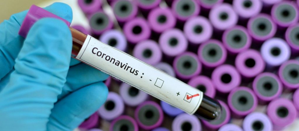 Κοροναϊός : Η ανάπτυξη στην ΕΕ ενδέχεται να πέσει φέτος «κάτω από το μηδέν»