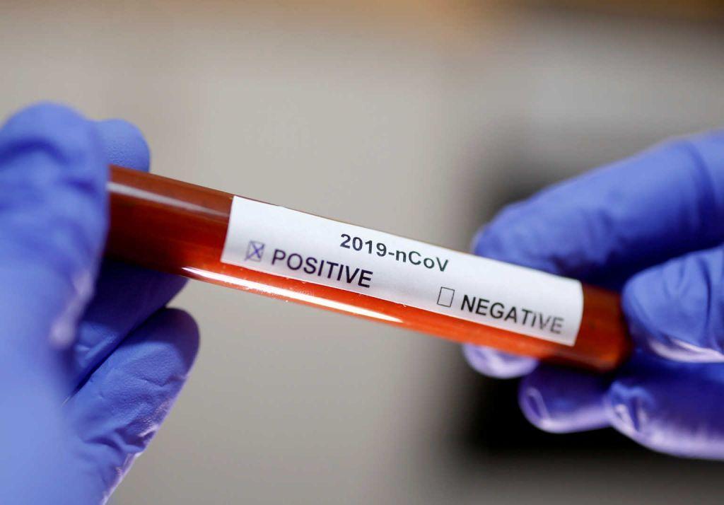 Ρώσοι επιστήμονες ξεκίνησαν δοκιμές εμβολίου κατά του ιού σε ζώα
