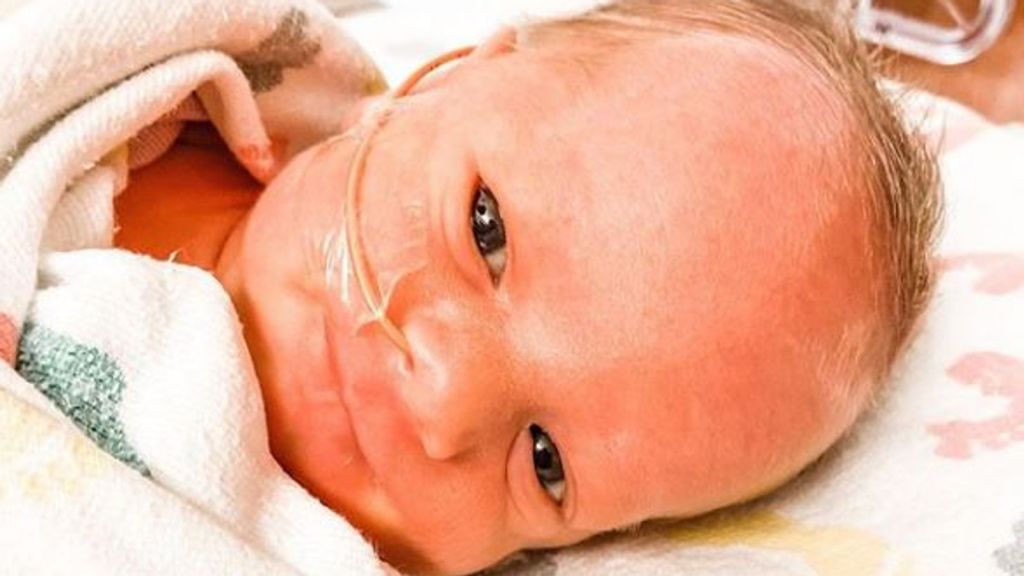 Συγκινητική στιγμή: Γέννησε ενώ βρισκόταν σε κώμα λόγω κοροναϊού