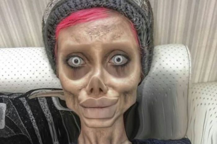 Σε κρίσιμη κατάσταση με κοροναϊό η Ιρανή «Αντζελίνα Τζολί»