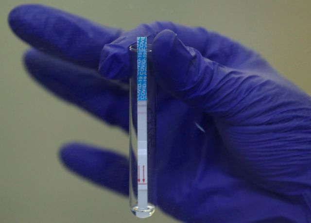 Κοροναϊός : Αυτά είναι τα νέα συμπτώματα της νόσου – Τι είπε ο Τσιόδρας