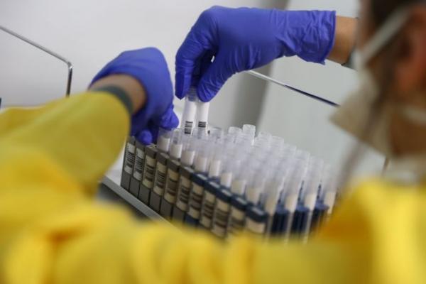 Κοροναϊός : Νέο τεστ υποσχέται αποτέλεσμα σε δύο ώρες