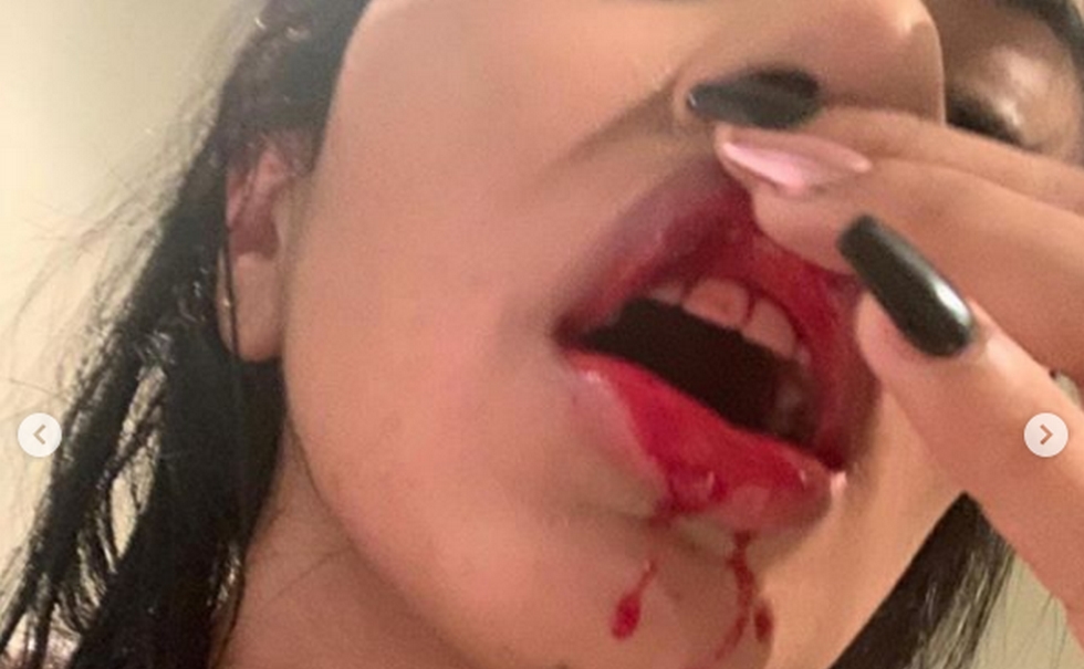 Σοκ: Παίκτης της Μπόκα βιαιοπραγεί κατά της συντρόφου του