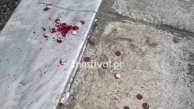 Θεσσαλονίκη: Σε αιματηρό επεισόδιο κατέληξε καυγάς