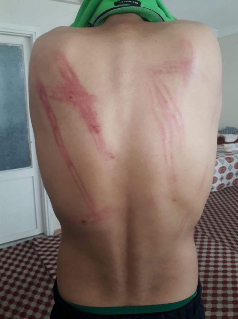 Ο κοροναϊος έβαλε σε «καραντίνα» τα δικαιώματα των προσφύγων – Επαναπροωθήσεις, βία και ναζιστικές πρακτικές