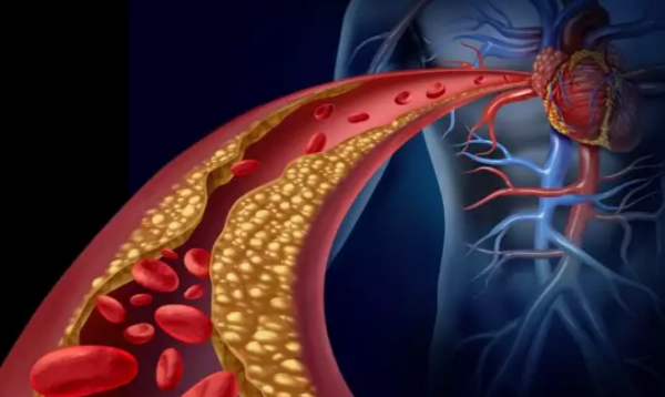 Χοληστερόλη : Πώς τη χρησιμοποιεί ο οργανισμός – Πότε υπάρχει πρόβλημα