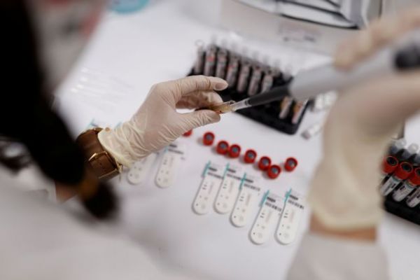 Κοροναϊός: Ενθαρρυντικά τα αποτελέσματα της κολχικίνης σύμφωνα με ελληνική μελέτη