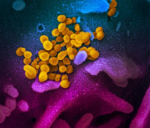 Nέες έρευνες: Γιατί η μετάλλαξη του ιού θα έκανε τον κοροναϊό ακόμη πιο μολυσματικό
