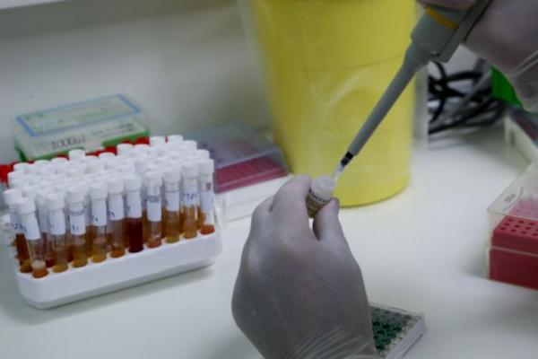 Βιοαισθητήρας από το Γεωπονικό Πανεπιστήμιο ανιχνεύει τον κοροναϊό σε τρία λεπτά