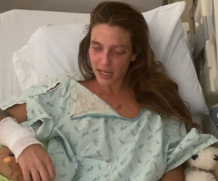 Κοπέλα τυφλώθηκε την ώρα που έφτιαχνε καλλυντικά