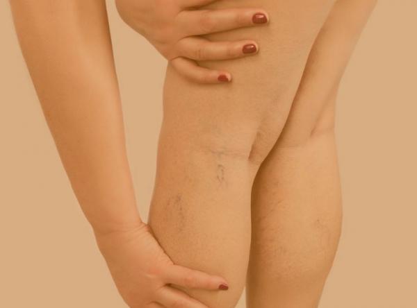 Κράμπες στα πόδια : Οι κίνδυνοι που μπορεί να σχετίζονται με αυτές