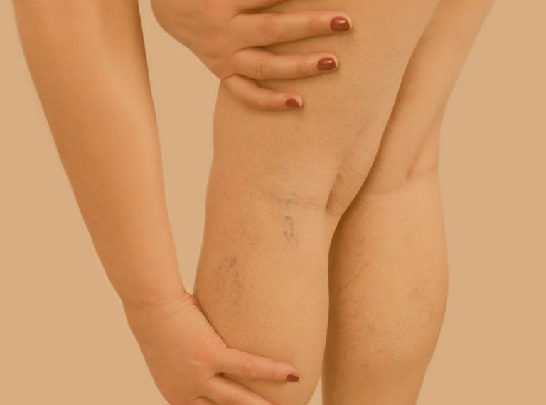 Κράμπες στα πόδια : Οι κίνδυνοι που μπορεί να σχετίζονται με αυτές