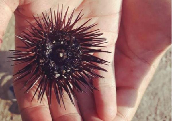 Τι να κάνετε αν πατήσετε αχινό στην παραλία;