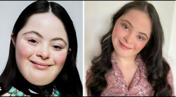 Ellie Goldstein: Γνωρίστε την 18χρονη νέα μούσα του Gucci με σύνδρομο Down