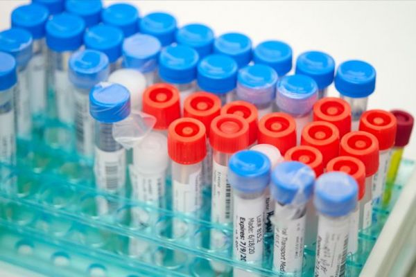 Ανησυχητικά στοιχεία για τις επιπτώσεις του κοροναϊού στην ψυχική υγεία – Τι λένε οι ειδικοί