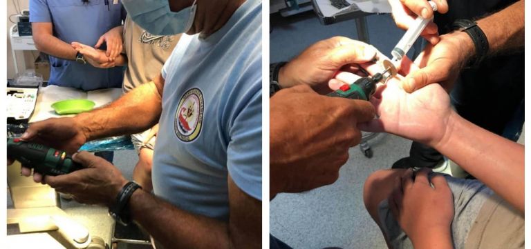 Βόλος: Επιχείρηση για να σωθεί το δάχτυλο 12χρονου που σφήνωσε σε fidget spinner