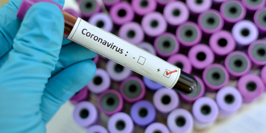 Κοροναϊός: Συναγερμός σε κυβέρνηση και επιστήμονες – Νέα σύσκεψη στο Μαξίμου