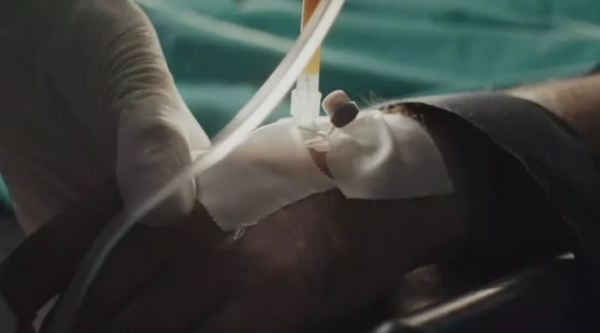 Ψευτογιατρός: Συγκλονίζουν νέες μαρτυρίες θυμάτων του