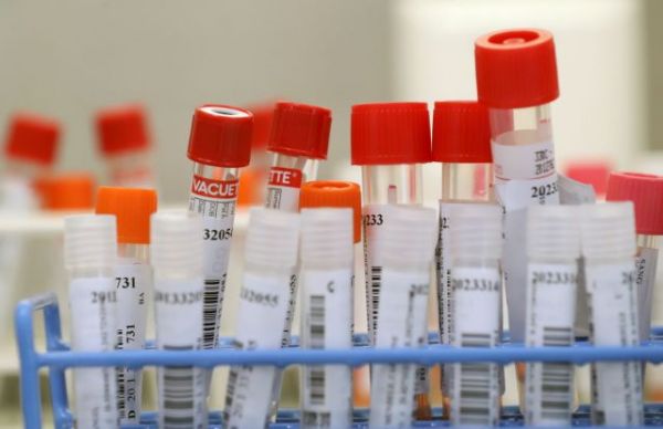 ΠΟΕΔΗΝ : Ανοχύρωτη στον κοροναϊό η Χαλκιδική – Δεν αξιοποιείται ο μοριακός αναλυτής