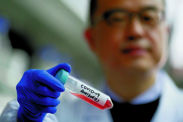 Κοροναϊός – Iταλία: Ξεκίνησαν δοκιμές σε εθελοντές για πιθανό εμβόλιο