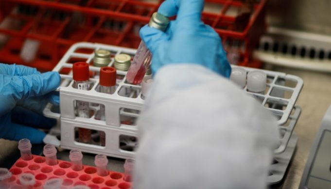 Αποκαλυπτική μελέτη για κοροναϊό: Έως 250 τα κρούσματα ημερησίως μέχρι τις 23 Αυγούστου στην Ελλάδα