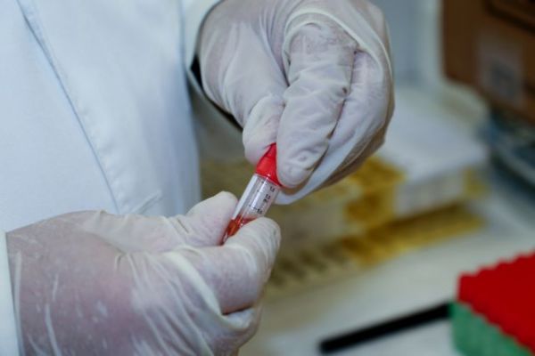 Αρκουμανέας : Πάνω από 13.000 στοχευμένα τα τεστ καθημερινά – Δηλώνονται όλα τα κρούσματα