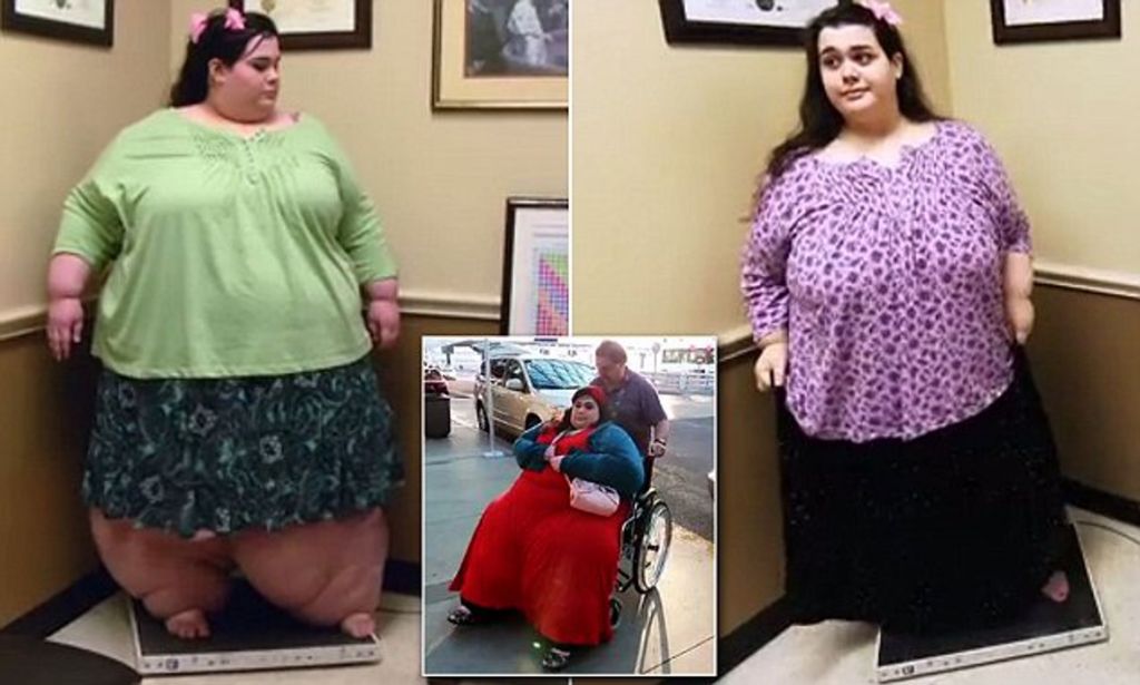 Amber Rachdi: Δείτε την συγκλονιστική μεταμόρφωση μιας γυναίκας που έχασε 181 κιλά