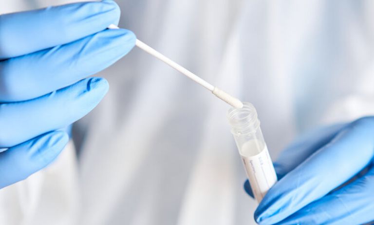 Ιταλία: Νέο τεστ σιέλου για διάγνωση κοροναϊού σε τρία λεπτά