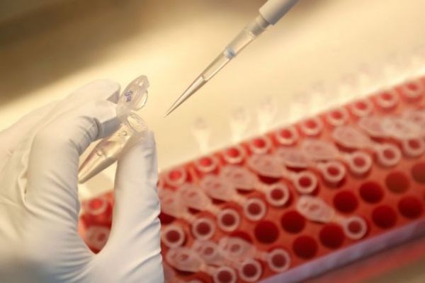 Κοροναϊός : Στα 46 τα κρούσματα στο εργοστάσιο στα Γιαννιτσά – Σαρωτικοί έλεγχοι