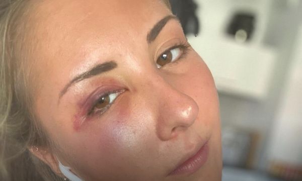 Σοκαριστικό περιστατικό στο Στρασβούργο: Ανεγκέφαλοι έδειραν φοιτήτρια επειδή φορούσε φούστα