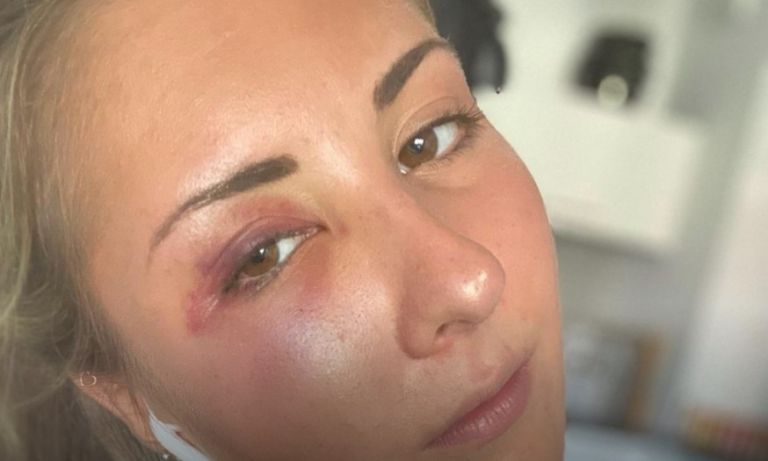 Σοκαριστικό περιστατικό στο Στρασβούργο: Ανεγκέφαλοι έδειραν φοιτήτρια επειδή φορούσε φούστα