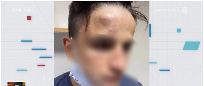 Συμμορία ανηλίκων ξυλοκόπησε άγρια 17χρονο στο Γαλάτσι - Τι λέει η οικογένειά του στο MEGA