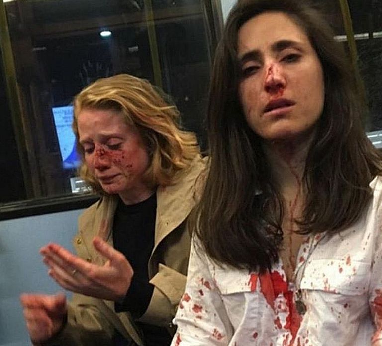 Ομοφυλόφιλο ζευγάρι γυναικών ζητά να ποινικοποιηθεί ο μισογυνισμός