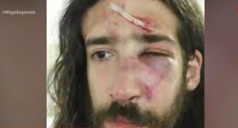 Χρυσή Αυγή : Σοκάρουν οι μαρτυρίες των θυμάτων της εγκληματικής οργάνωσης