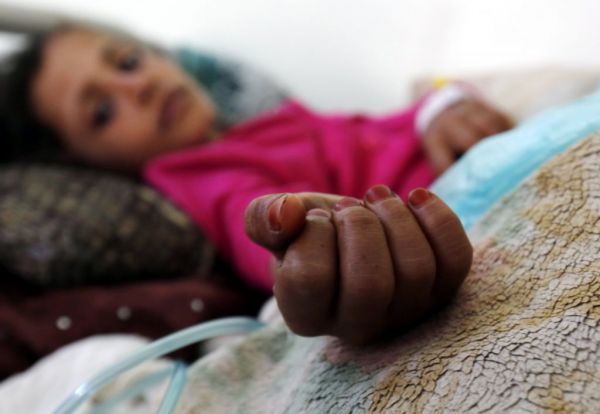 Υεμένη : Σε πρωτόγνωρα επίπεδα έχει φτάσει ο υποσιτισμός των παιδιών