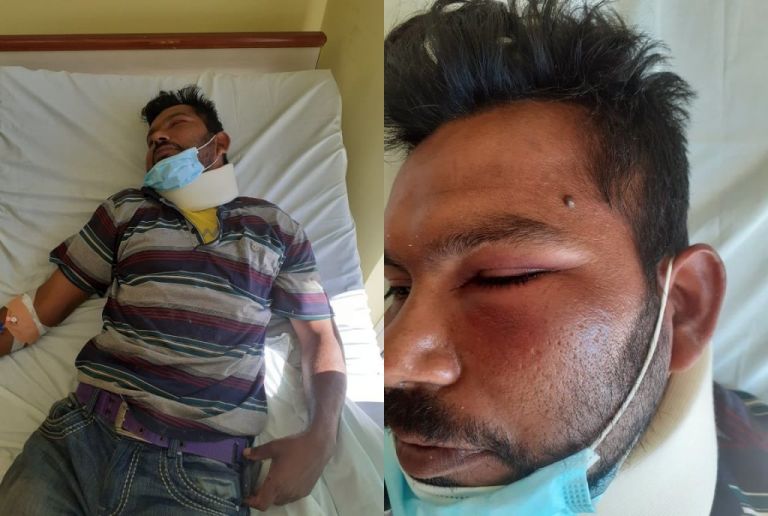 Ηλεία : Ξυλοδαρμός μετανάστη εργάτη επειδή ζήτησε τα λεφτά του