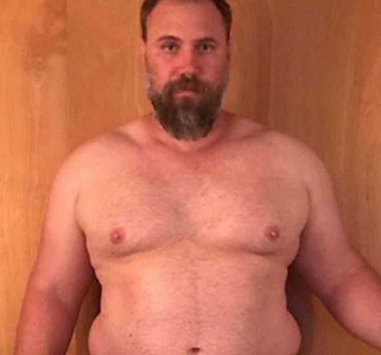 Σοκ : Δείτε πώς αδυνάτισε αυτός ο άντρας μέσα σε μόλις 5 μήνες αλλάζοντας ριζικά τη ζωή του – Φώτο