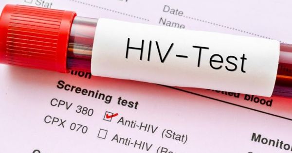 Αυξάνονται οι αδιάγνωστες περιπτώσεις του HIV στην Ευρώπη