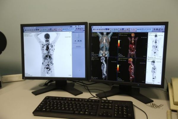 Οι πολλές ακτινογραφίες αυξάνουν τον κίνδυνο για καρκίνο των όρχεων